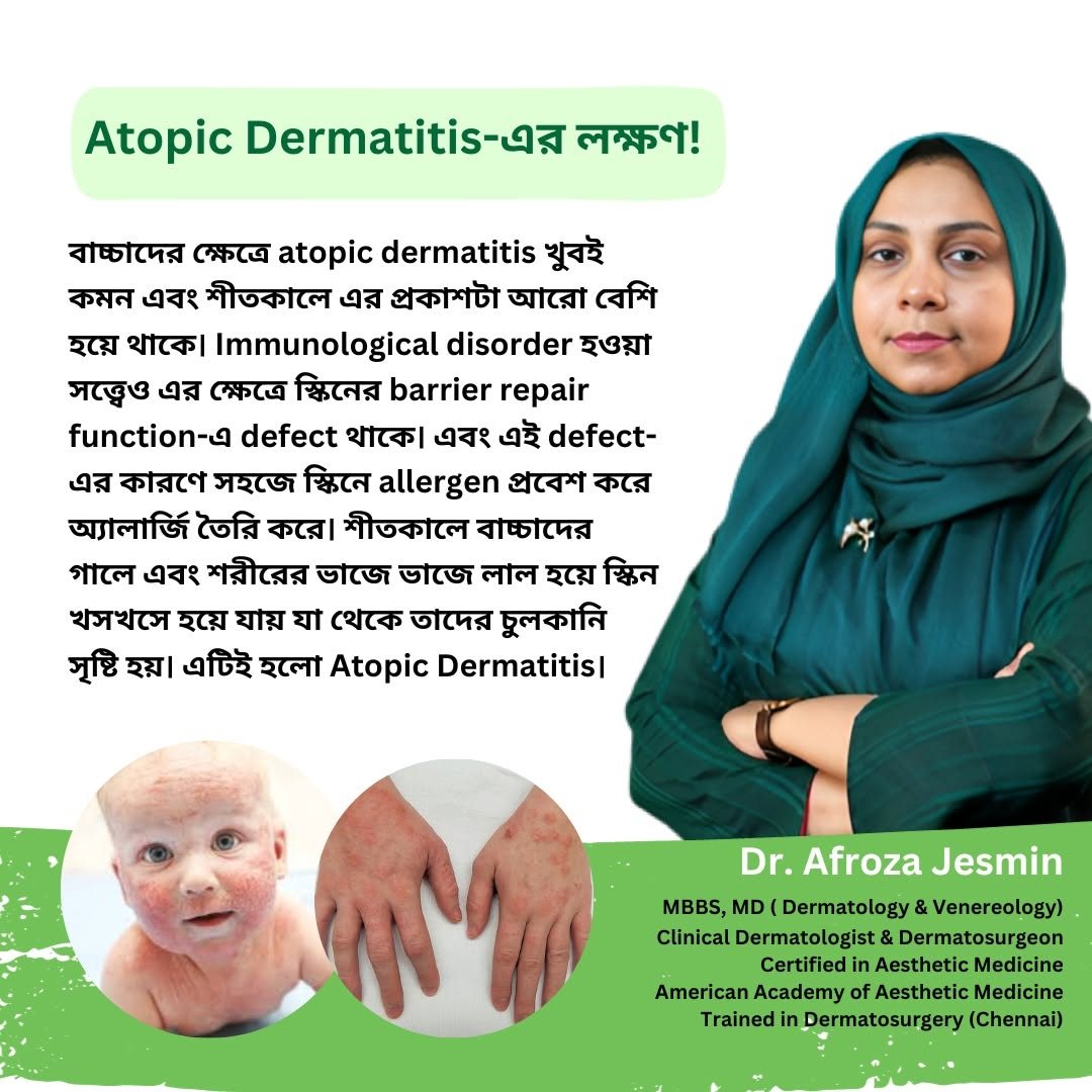 শিশুদের অ্যাটোপিক ডার্মাটাইটিসের লক্ষণ ব্যাখ্যা করছেন ডাঃ আফরোজা জেসমিন